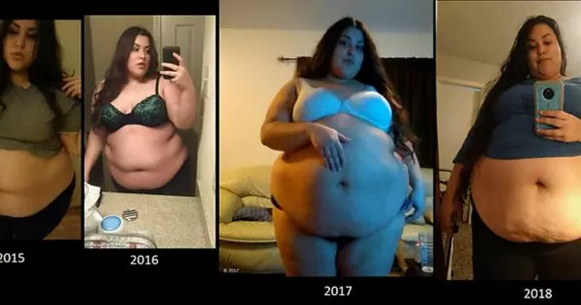 Itraconazole and weight gain: Understanding the potential side effect